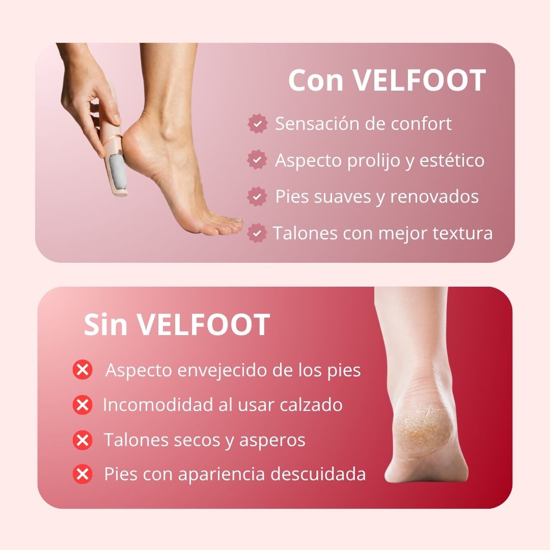 Removedor de callos-Pies suaves y cuidados