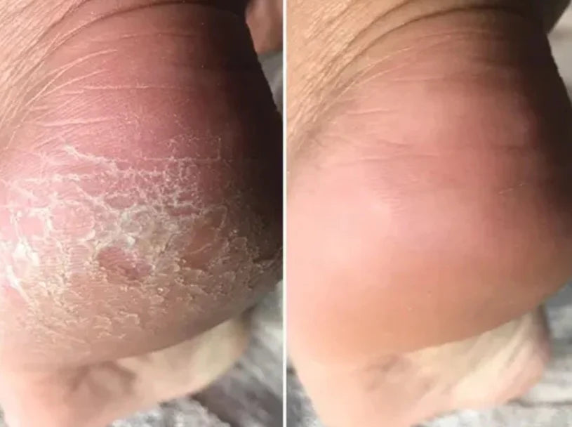 Me daba vergüenza mostrar mis pies